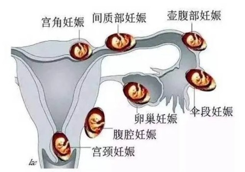 西安助孕生子：肇慶西江醫(yī)院試管嬰兒怎么樣？內附技術介紹及其成功率