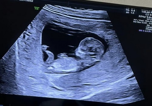西安供卵試管：2023新余婦幼保健院試管嬰兒全方位指南，費用明細(xì)及成功率參考