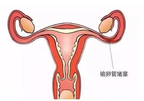 尿不濕過期了還能用嗎？用尿不濕不注意這些事情可能會(huì)危害寶寶身體